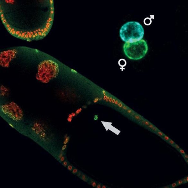 Epigenetic