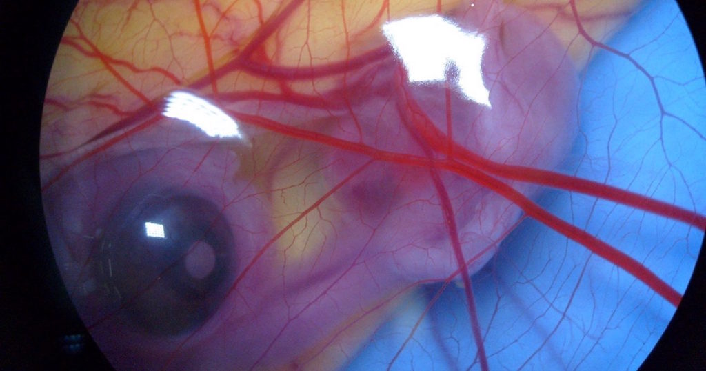 embryonic development