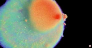 oocyte