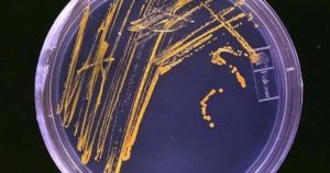 bacteria