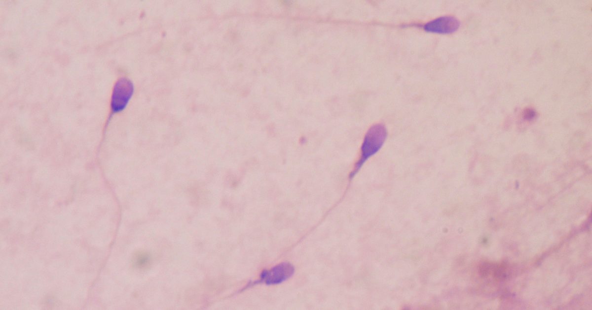 sperm