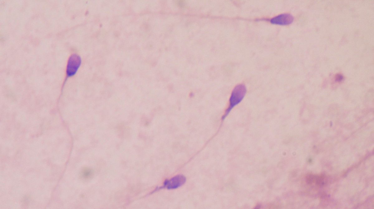 sperm