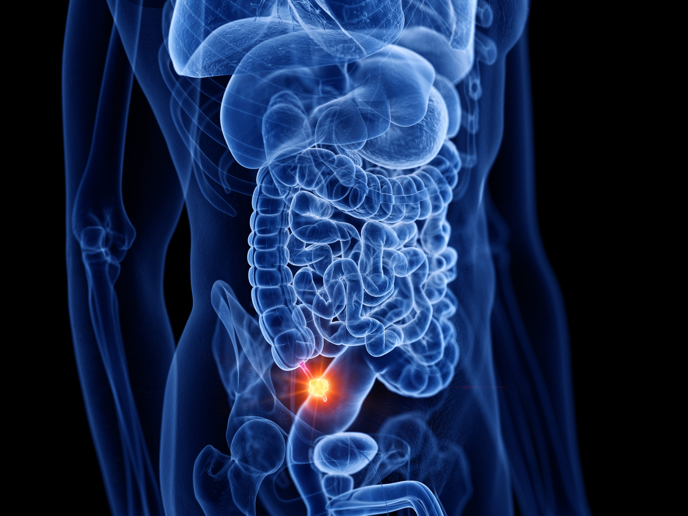 3d rendered medically accurate illustration of appendix