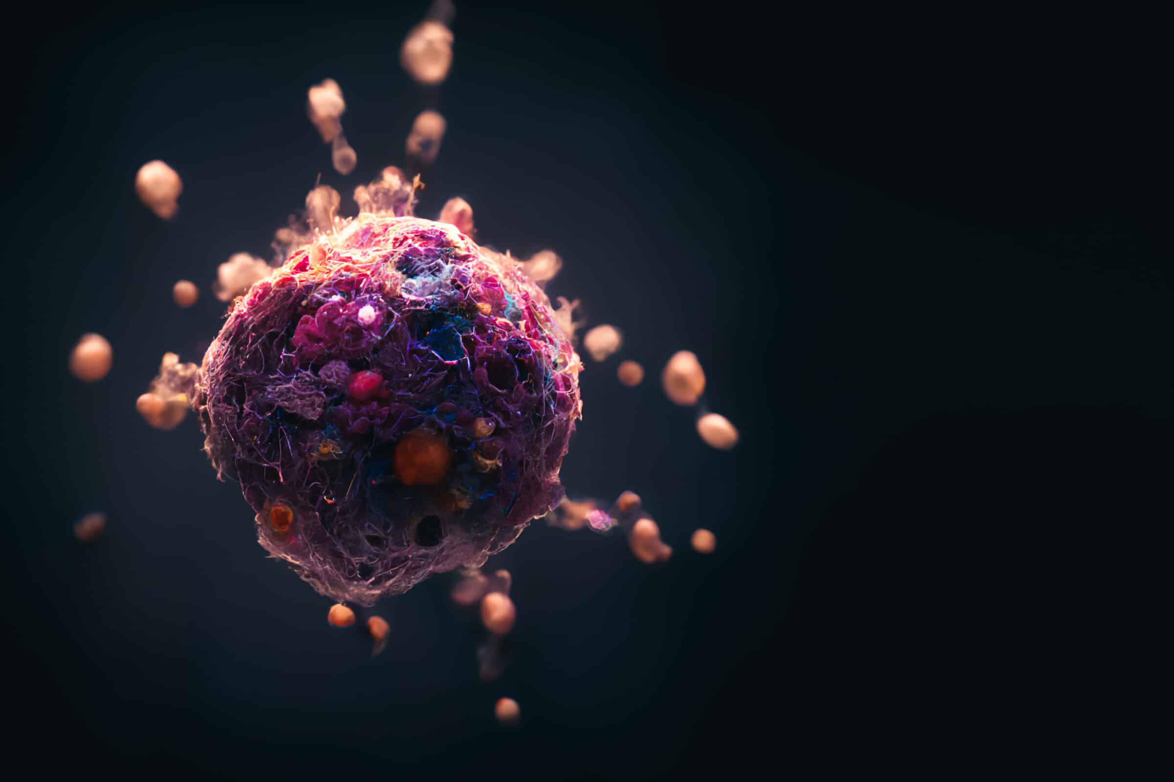 Nanoparticles destroying cancer cells, nanoparticles cancer therapy, cancer cell surrounded by nanoparticles killing the tumor 3d rendering