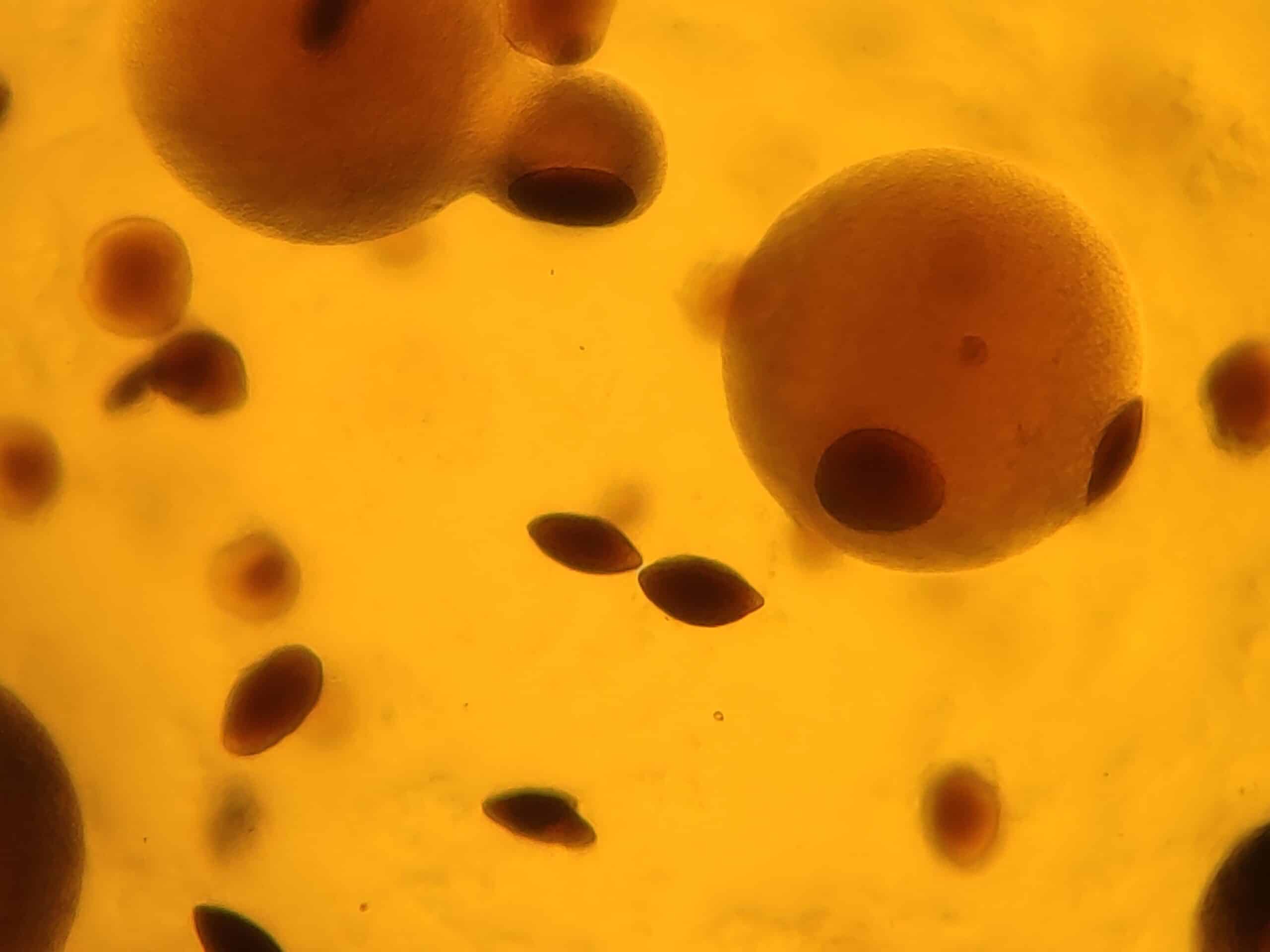 Rob Stadler on the “Low Confidence” Science of Darwinism