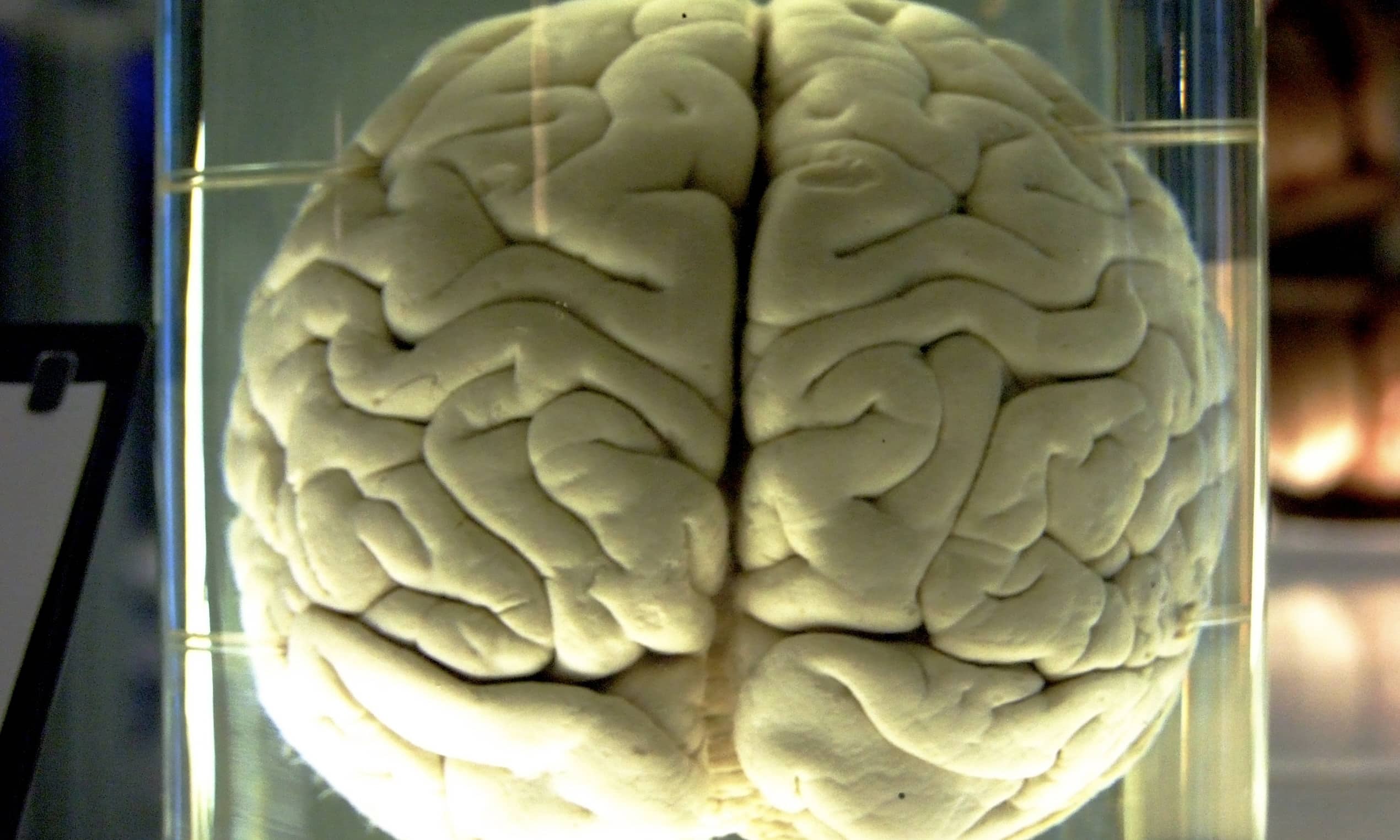Remarkable Engineering and the “Two Brains” Myth